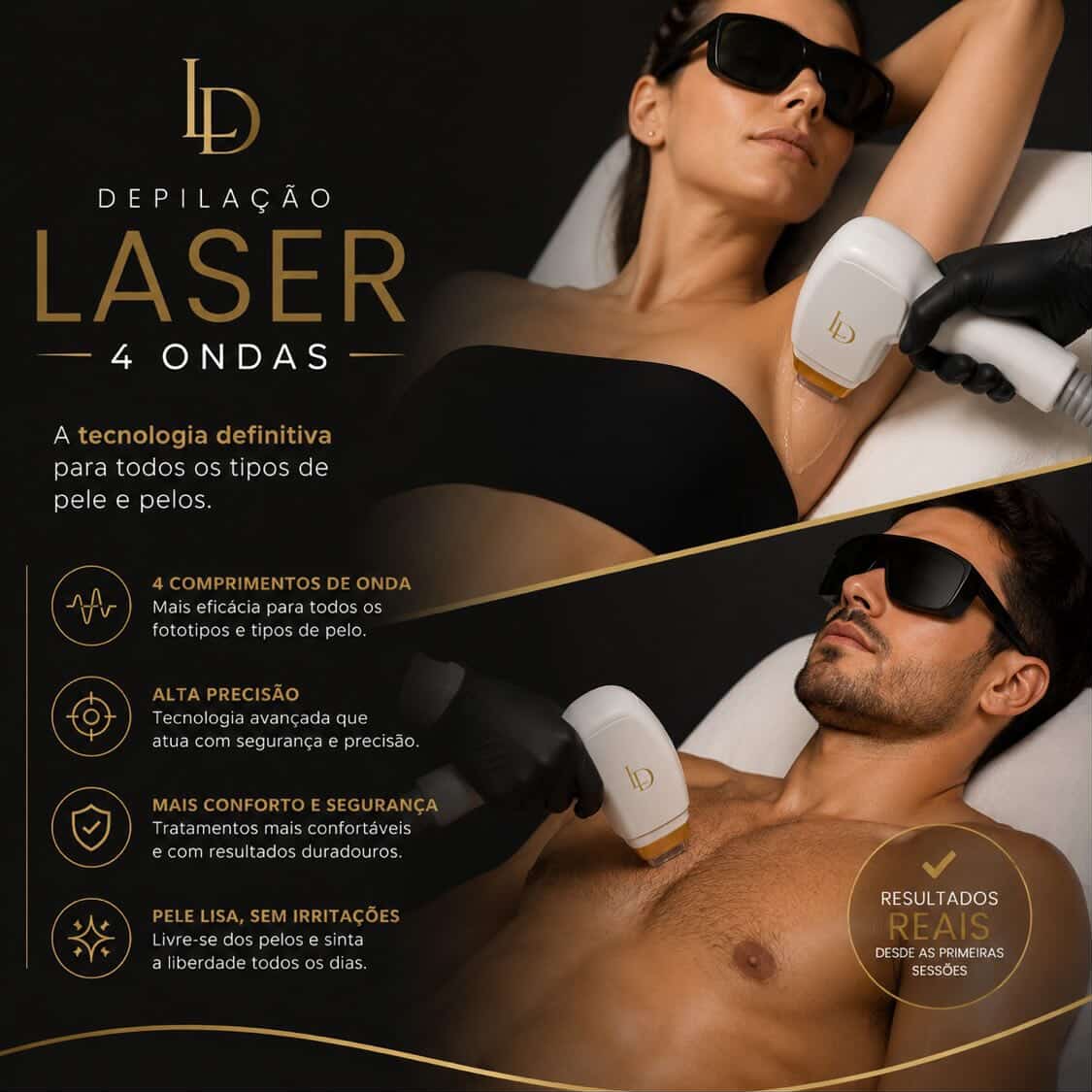 Depilação Laser 4 Ondas